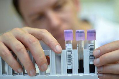 Um técnico de laboratório exibe amostras de sangue.