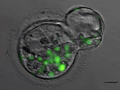Embriões humanos no início do desenvolvimento.