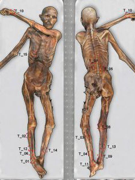 Mapa das tatuagens do homem de gelo, Ötzi.