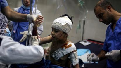 Menino de 10 anos recebe atendimento médico por ferimentos causados pela ofensiva israelense, nesta quinta-feira, na cidade de Khan Younis, no sul da Faixa de Gaza.
