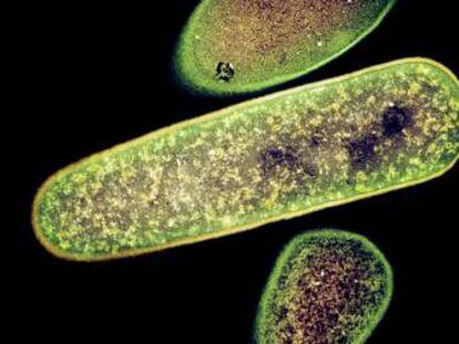 Bactéria que pode gerar infecção de cólon