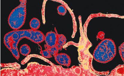 Imagem de um vírus infectando uma célula.