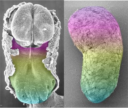 Comparación de un embrión humano de 18 a 21 días, a la izquierda, y el modelo de embrión artificial. Los colores indican la expresión de los mismos genes. En el embrión real la parte superior corresponde al cerebro, ausente en el modelo.