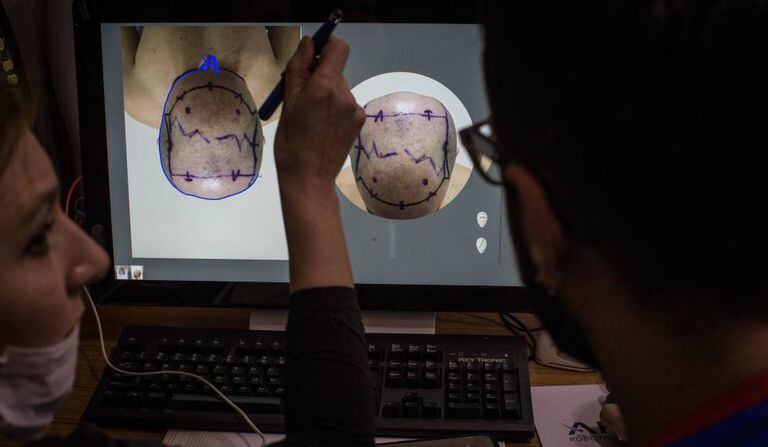 Médicos avaliam um paciente em uma clínica turca.