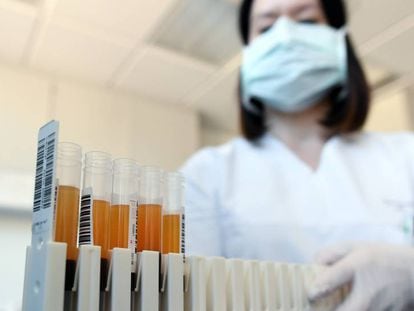 Amostras de sangue e plasma em um laboratório na Alemanha que, assim como o Brasil, investiga a cura do coronavírus.