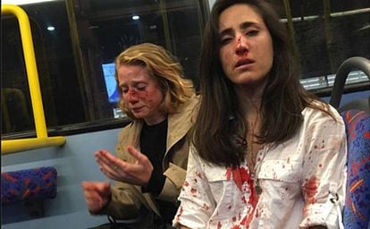 Melania Geymonat (à direita) e sua namorada, Chris, depois da agressão que sofreram em um ônibus de Londres em 30 de maio.
