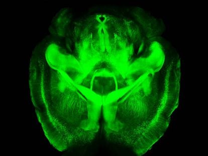 Imagem de um cérebro de camundongo.
