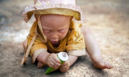 Uma criança albina em Tanzania.