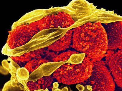 Em amarelo, a bactéria 'Staphylococcus aureus' escapa de um glóbulo branco.