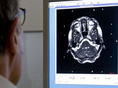 Os tumores cerebrais benignos provocam cefaleias e obesidade.