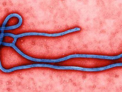 O vírus do Ebola.
