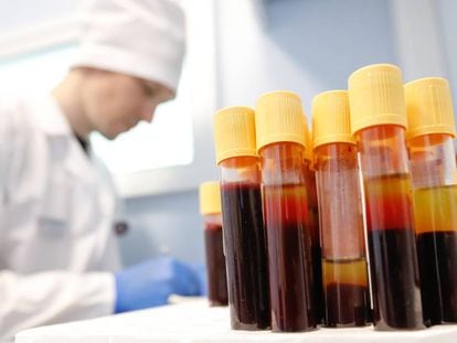 Amostras de sangue de portadores do vírus HIV em um laboratório russo.