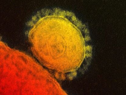 Imagem do coronavírus (amarelo) do Instituto Nacional para Alergia e as Enfermidades Infecciosas.