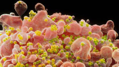 Imagem microscópica do vírus do HIV.