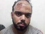 Jefferson Luiz Rangel Marconi logo após ser detido e torturado por forças de segurança no Rio de Janeiro, em 2018.