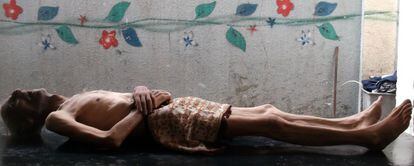 O corpo de Awad al-Said, que morreu de fome, segundo moradores de Yarmuk, em Damasco. / AP