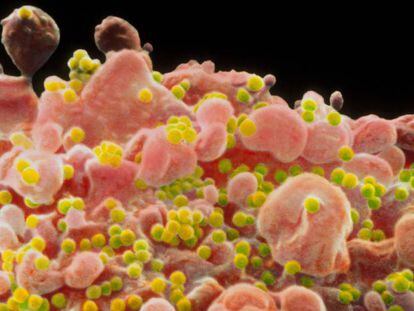 Imagem microscópica do vírus do HIV.