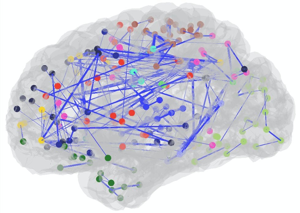 O mapa do cérebro de Gareyev mostra suas numerosas conexões.