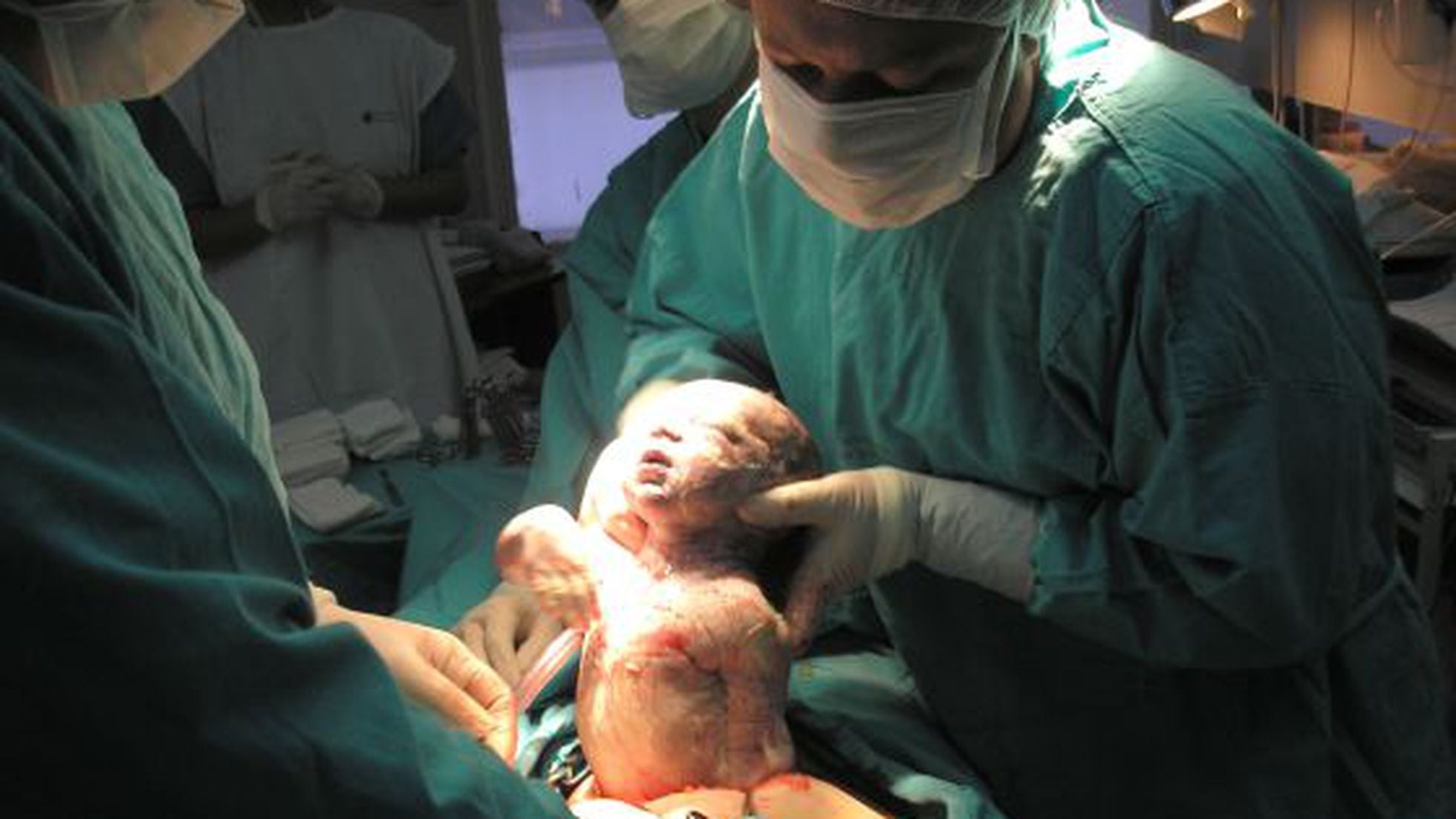 GeHosp – Gestão Hospitalar Parto cesárea também pode ser humanizado como o  parto normal