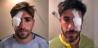 Lamardo e Pérez foram feridos por estilhaços no ataque ao ônibus do Boca Juniors.
