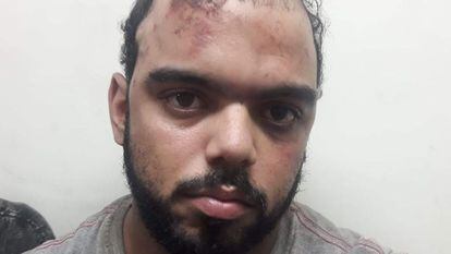 Jefferson Luiz Rangel Marconi logo após ser detido e torturado por forças de segurança no Rio de Janeiro, em 2018.