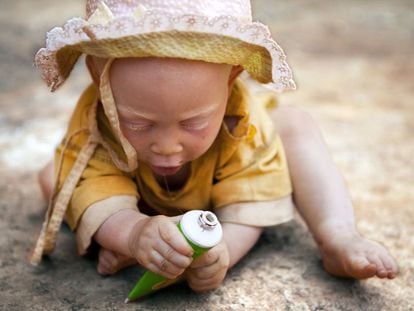Uma criança albina em Tanzania.