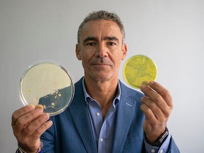 O microbiologista Bruno González Zorn mostra dois cultivos bacterianos em sua sala na Universidade Complutense de Madri.