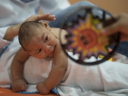 Uma criança com microcefalia em Recife, Brasil.
