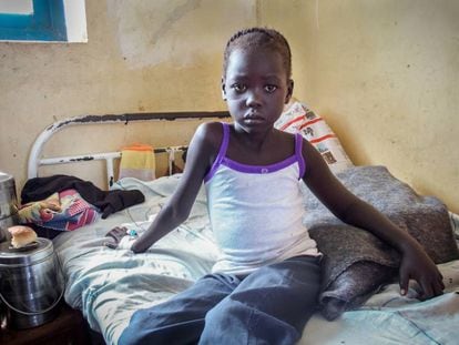 Nyajinma, 6, foi mordida por uma cobra enquanto dormia no do Sudão do Sul.