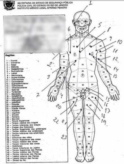 A autópsia que mostra os 30 tiros no corpo do pastor Anderson do Carmo.