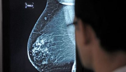 Médico observa uma mamografia no hospital Virgen del Rocío, em Sevilha.