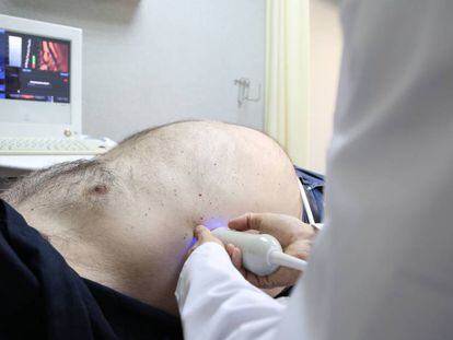 Especialista examina paciente no hospital Vall d’Hebron, em Barcelona.