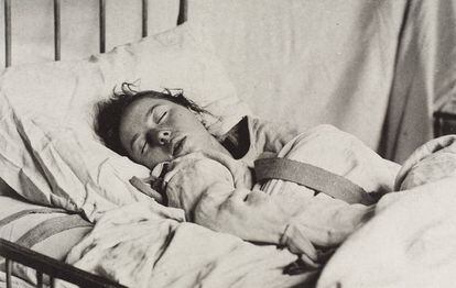 Uma mulher com uma camisa de força, diagnosticada com histeria, em uma foto publicada em 1889.