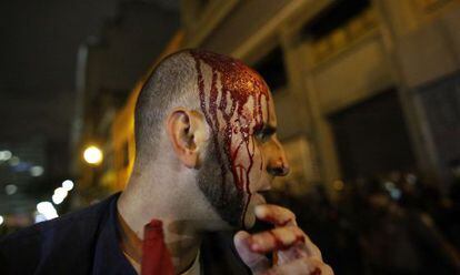 Manifestante ferido, nesta sexta, em S&atilde;o Paulo.