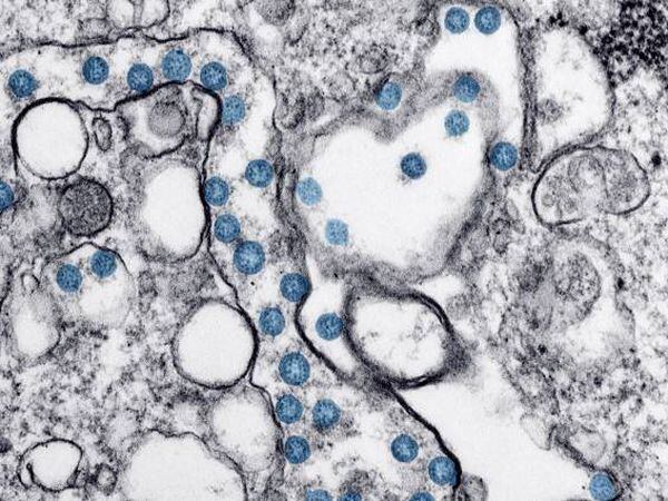 Imagen al microscopio de coronavirus.
