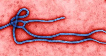 O vírus do Ebola.