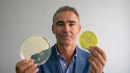 O microbiologista Bruno González Zorn mostra dois cultivos bacterianos em sua sala na Universidade Complutense de Madri.