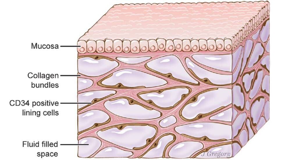 Recriação artística das cavidades do interstício sob a pele.