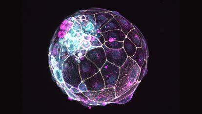 Um dos pseudoembriões com células-tronco humanas.
