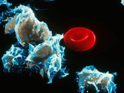 Células com leucemia (esquerda) junto a um glóbulo vermelho