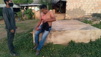 Liderança da aldeia de Tabatinga, na Terra Indígena Raposa Serra do Sol, é ferida durante ação de policiais militares na terça-feira, 16 de novembro, em Roraima.