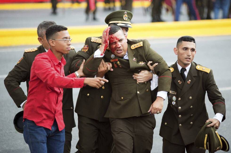 Um militar venezuelano ferido, momentos depois do incidente