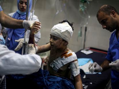 Menino de 10 anos recebe atendimento médico por ferimentos causados pela ofensiva israelense, nesta quinta-feira, na cidade de Khan Younis, no sul da Faixa de Gaza.