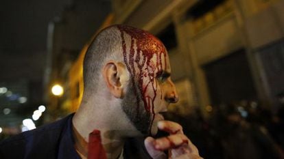 Manifestante ferido, nesta sexta, em S&atilde;o Paulo.