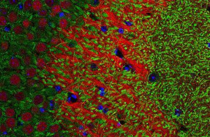 Detecção da proteína (em verde) do gene Crtc1 em neurônios do hipocampo de um camundongo.