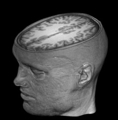 Uma imagem do cérebro de Garéyev