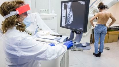 Uma mulher faz uma mamografia em um hospital da Catania (Itália), no ano passado.
