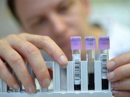 Um técnico de laboratório exibe amostras de sangue.