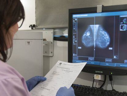 Médica examina uma radiografia de mama.