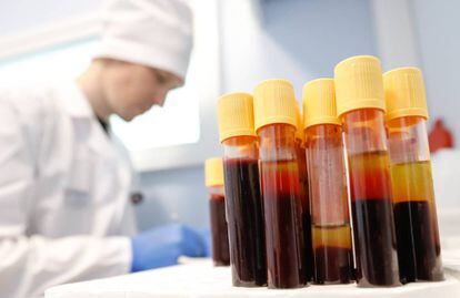 Amostras de sangue de portadores do vírus HIV em um laboratório russo.